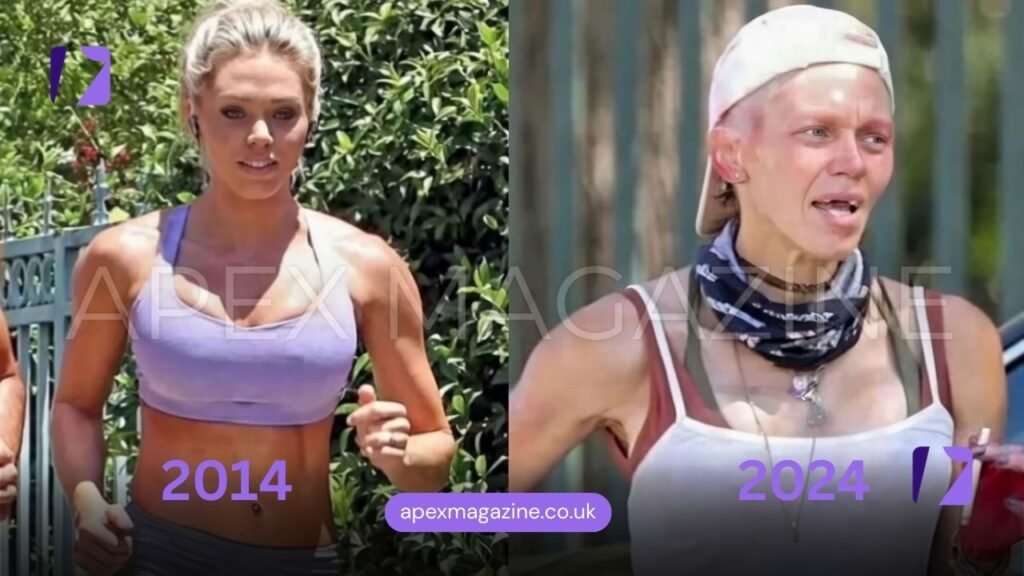 Loni Willison’s Life Changed After Fame