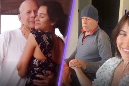 Bruce Willis Disease