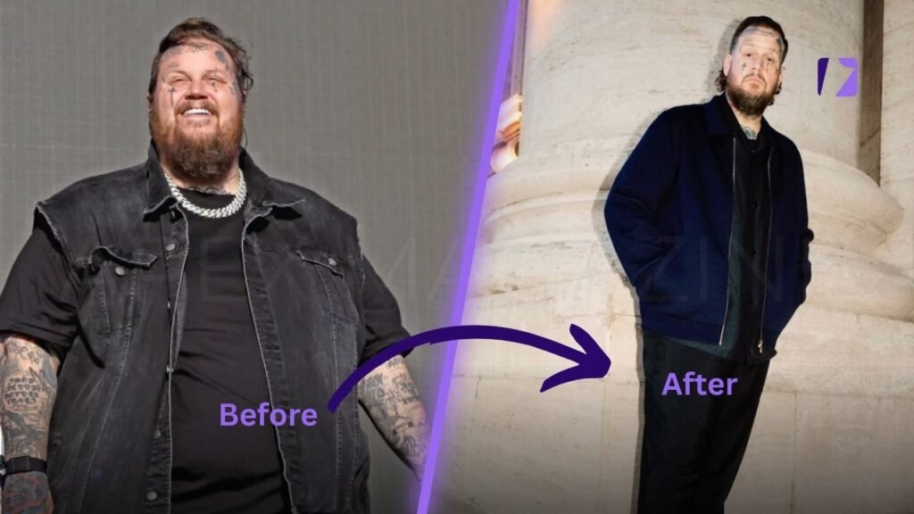 Jelly Roll Weight Loss Before and After
