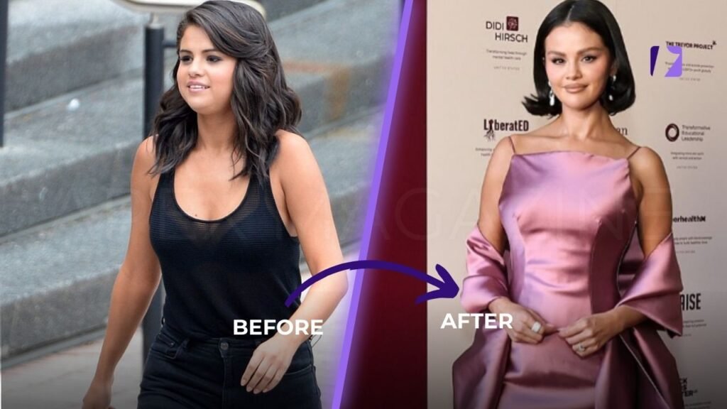 Selena Gomez Weight Loss Before and After comparison